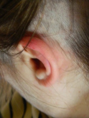 The area above ear left
